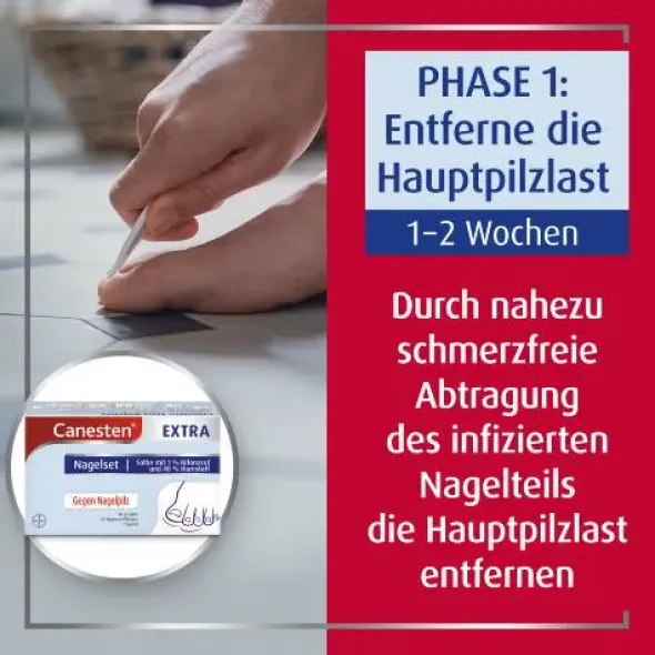 CANESTEN Extra Nagelset 1 St