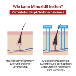 MINOXIDIL DoppelherzPhar.50mg/ml Lsg.Anw.Haut Mann 3X60 ml