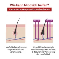 MINOXIDIL DoppelherzPhar.20mg/ml Lsg.Anw.Haut Frau 3X60 ml