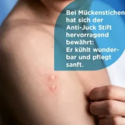 SOVENTOL Anti-Juck Stift Gel 4 ml